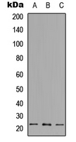 Western blot analysis of RPL18 expression in Jurkat (A); HeLa (B); NIH3T3 (C) whole cell lysates.
