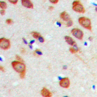 Immunohistochemical analysis of RPL22 staining in human brain formalin fixed paraffin embedded tissue section. The section was pre-treated using heat mediated antigen retrieval with sodium citrate buffer (pH 6.0). The section was then incubated with the antibody at room temperature and detected using an HRP conjugad compact polymer system. DAB was used as the chromogen. The section was then counterstained with haematoxylin and mounted with DPX.