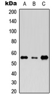 Western blot analysis of Rhotekin expression in HeLa (A); Raw264.7 (B); PC12 (C) whole cell lysates.