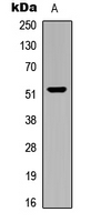 Western blot analysis of CARKL expression in human brain (A) whole cell lysates.