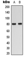 Western blot analysis of SMIT1 expression in human prostate (A); rat kidney (B) whole cell lysates.