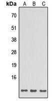 Western blot analysis of SPINK6 expression in HeLa (A); Raw264.7 (B); H9C2 (C) whole cell lysates.