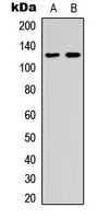 Western blot analysis of ST5 expression in K562 (A); human spleen (B) whole cell lysates.