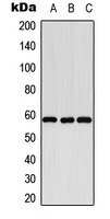 Western blot analysis of Cytochrome P450 8B1 expression in K562 (A); SP2/0 (B); PC12 (C) whole cell lysates.