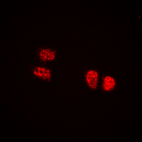 Immunofluorescent analysis of TCOF1 staining in HEK293T cells. Formalin-fixed cells were permeabilized with 0.1% Triton X-100 in TBS for 5-10 minutes and blocked with 3% BSA-PBS for 30 minutes at room temperature. Cells were probed with the primary antibody in 3% BSA-PBS and incubated overnight at 4 deg C in a hidified chamber. Cells were washed with PBST and incubated with a DyLight 594-conjugated secondary antibody (red) in PBS at room temperature in the dark. DAPI was used to stain the cell nuclei (blue).