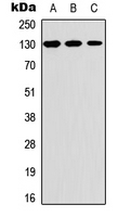 Western blot analysis of Thrombospondin 2 expression in A549 (A); Raw264.7 (B); PC12 (C) whole cell lysates.