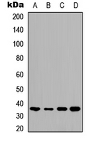 Western blot analysis of TMBIM1 expression in HeLa (A); HepG2 (B); mouse brain (C); rat kidney (D) whole cell lysates.