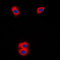 Immunofluorescent analysis of Cytochrome P450 11A1 staining in Jurkat cells. Formalin-fixed cells were permeabilized with 0.1% Triton X-100 in TBS for 5-10 minutes and blocked with 3% BSA-PBS for 30 minutes at room temperature. Cells were probed with the primary antibody in 3% BSA-PBS and incubated overnight at 4 C in a humidified chamber. Cells were washed with PBST and incubated with a DyLight 594-conjugated secondary antibody (red) in PBS at room temperature in the dark. DAPI was used to stain the cell nuclei (blue).