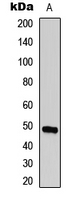 Western blot analysis of ECHOS1 expression in A431 (A) whole cell lysates.