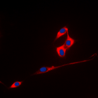 Immunofluorescent analysis of ECHOS1 staining in A431 cells. Formalin-fixed cells were permeabilized with 0.1% Triton X-100 in TBS for 5-10 minutes and blocked with 3% BSA-PBS for 30 minutes at room temperature. Cells were probed with the primary antibody in 3% BSA-PBS and incubated overnight at 4 deg C in a hidified chamber. Cells were washed with PBST and incubated with a DyLight 594-conjugated secondary antibody (red) in PBS at room temperature in the dark. DAPI was used to stain the cell nuclei (blue).