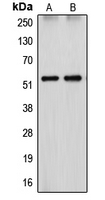 Western blot analysis of Cytochrome P450 26A1 expression in HepG2 (A); HEK293T (B) whole cell lysates.
