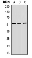 Western blot analysis of VIPR1 expression in A549 (A); H9C2 (B); Raw264.7 (C) whole cell lysates.