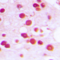 Immunohistochemical analysis of ZNF232 staining in human testis formalin fixed paraffin embedded tissue section. The section was pre-treated using heat mediated antigen retrieval with sodium citrate buffer (pH 6.0). The section was then incubated with the antibody at room temperature and detected using an HRP conjugad compact polymer system. DAB was used as the chromogen. The section was then counterstained with haematoxylin and mounted with DPX.