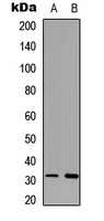 Western blot analysis of 42064 expression in K562 (A); mouse brain (B) whole cell lysates.