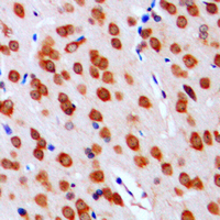 Immunohistochemical analysis of DGK alpha staining in human brain formalin fixed paraffin embedded tissue section. The section was pre-treated using heat mediated antigen retrieval with sodium citrate buffer (pH 6.0). The section was then incubated with the antibody at room temperature and detected using an HRP conjugated compact polymer system. DAB was used as the chromogen. The section was then counterstained with haematoxylin and mounted with DPX.