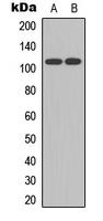 Western blot analysis of Ataxin 1 (pS775) expression in HEK293T (A); mouse brain (B) whole cell lysates.