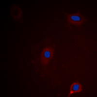 Immunofluorescent analysis of Ataxin 1 (pS775) staining in HEK293 cells. Formalin-fixed cells were permeabilized with 0.1% Triton X-100 in TBS for 5-10 minutes and blocked with 3% BSA-PBS for 30 minutes at room temperature. Cells were probed with the primary antibody in 3% BSA-PBS and incubated overnight at 4 deg C in a hidified chamber. Cells were washed with PBST and incubated with a DyLight 594-conjugated secondary antibody (red) in PBS at room temperature in the dark. DAPI was used to stain the cell nuclei (blue).