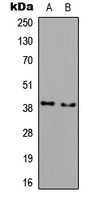 Western blot analysis of DGAT2L3 expression in COLO205 (A); NIH3T3 (B) whole cell lysates.