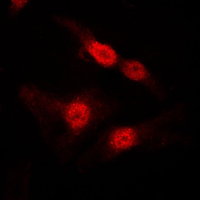 Immunofluorescent analysis of DGK alpha staining in MDCK cells. Formalin-fixed cells were permeabilized with 0.1% Triton X-100 in TBS for 5-10 minutes and blocked with 3% BSA-PBS for 30 minutes at room temperature. Cells were probed with the primary antibody in 3% BSA-PBS and incubated overnight at 4 C in a humidified chamber. Cells were washed with PBST and incubated with a DyLight 594-conjugated secondary antibody (red) in PBS at room temperature in the dark. DAPI was used to stain the cell nuclei (blue).