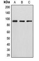 Western blot analysis of DGK beta expression in HT29 (A); MCF7 (B); HeLa (C) whole cell lysates.