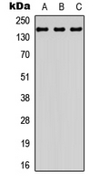 Western blot analysis of BCR expression in HepG2 (A); mouse brain (B); rat brain (C) whole cell lysates.