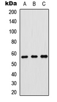 Western blot analysis of p57 Kip2 expression in HeLa (A); SHSY5Y (B); rat brain (C) whole cell lysates.