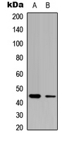 Western blot analysis of CLN5 expression in HEK293T (A); NIH3T3 (B) whole cell lysates.