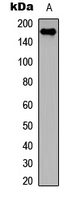 Western blot analysis of Collagen 11 alpha 2 expression in COLO205 (A) whole cell lysates.