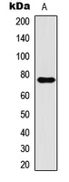 Western blot analysis of CPT1B expression in HT1080 (A) whole cell lysates.