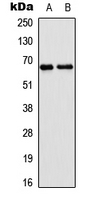 Western blot analysis of EPN2 expression in HEK293T (A); NIH3T3 (B) whole cell lysates.