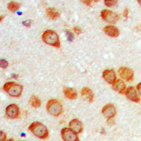 Immunohistochemical analysis of EPN3 staining in human brain formalin fixed paraffin embedded tissue section. The section was pre-treated using heat mediated antigen retrieval with sodium citrate buffer (pH 6.0). The section was then incubated with the antibody at room temperature and detected using an HRP conjugad compact polymer system. DAB was used as the chromogen. The section was then counterstained with haematoxylin and mounted with DPX.