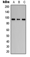 Western blot analysis of Filaggrin expression in HeLa (A); NS-1 (B); PC12 (C) whole cell lysates.