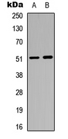 Western blot analysis of GABRA6 expression in Jurkat (A); mouse brain (B) whole cell lysates.