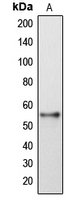 Western blot analysis of DFNA5 expression in HeLa (A) whole cell lysates.