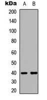 Western blot analysis of LMTK3 expression in SHSY5Y (A); NIH3T3 (B) whole cell lysates.