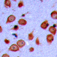Immunohistochemical analysis of LMTK3 staining in human brain formalin fixed paraffin embedded tissue section. The section was pre-treated using heat mediated antigen retrieval with sodium citrate buffer (pH 6.0). The section was then incubated with the antibody at room temperature and detected using an HRP conjugad compact polymer system. DAB was used as the chromogen. The section was then counterstained with haematoxylin and mounted with DPX.