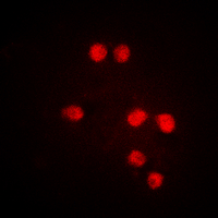 Immunofluorescent analysis of TRAP220 (pT1457) staining in Jurkat cells. Formalin-fixed cells were permeabilized with 0.1% Triton X-100 in TBS for 5-10 minutes and blocked with 3% BSA-PBS for 30 minutes at room temperature. Cells were probed with the primary antibody in 3% BSA-PBS and incubated overnight at 4 deg C in a hidified chamber. Cells were washed with PBST and incubated with a DyLight 594-conjugated secondary antibody (red) in PBS at room temperature in the dark. DAPI was used to stain the cell nuclei (blue).