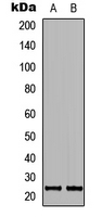 Western blot analysis of MRPL40 expression in SHSY5Y (A); NIH3T3 (B) whole cell lysates.