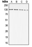 Western blot analysis of DIAPH2 expression in A431 (A); HCT116 (B); SP2/0 (C); PC12 (D) whole cell lysates.