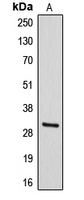 Western blot analysis of DIO3 expression in HepG2 (A) whole cell lysates.