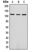 Western blot analysis of PSD93 expression in Jurkat (A); SHSY5Y (B); HepG2 (C) whole cell lysates.