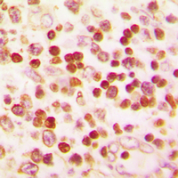 Immunohistochemical analysis of PAX1 staining in human lymph node formalin fixed paraffin embedded tissue section. The section was pre-treated using heat mediated antigen retrieval with sodium citrate buffer (pH 6.0). The section was then incubated with the antibody at room temperature and detected using an HRP conjugad compact polymer system. DAB was used as the chromogen. The section was then counterstained with haematoxylin and mounted with DPX.