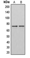 Western blot analysis of DMPK expression in HeLa (A); Jurkat (B) whole cell lysates.