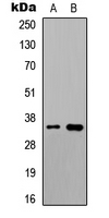 Western blot analysis of UBR1 expression in HeLa (A); rat muscle (B) whole cell lysates.