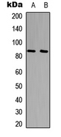 Western blot analysis of UTP14A expression in HepG2 (A); HeLa (B) whole cell lysates.