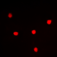 Immunofluorescent analysis of UTP14A staining in HeLa cells. Formalin-fixed cells were permeabilized with 0.1% Triton X-100 in TBS for 5-10 minutes and blocked with 3% BSA-PBS for 30 minutes at room temperature. Cells were probed with the primary antibody in 3% BSA-PBS and incubated overnight at 4 deg C in a hidified chamber. Cells were washed with PBST and incubated with a DyLight 594-conjugated secondary antibody (red) in PBS at room temperature in the dark. DAPI was used to stain the cell nuclei (blue).