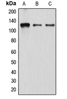 Western blot analysis of Atrophin-1 expression in K562 (A); EOC20 (B); HeLa (C) whole cell lysates.