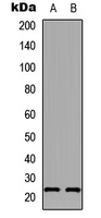 Western blot analysis of AANAT expression in A549 (A); PC12 (B) whole cell lysates.