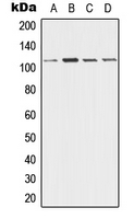 Western blot analysis of Desmoglein 3 expression in A431 (A); HeLa (B); Raw264.7 (C); PC12 (D) whole cell lysates.