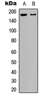 Western blot analysis of BAI1 expression in HepG2 (A); human brain (B) whole cell lysates.